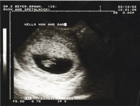 IMG_20171021_0001 (2)